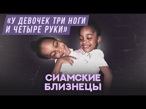 Сиамские близнецы | Хочу спросить