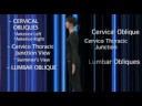Chiropractic DVD Vol4 X-Ray Positioning Technique training