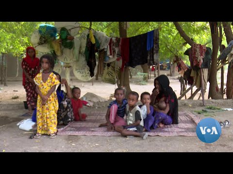 🔵Ethiopia’s Struggling Displaced People Face Dilemma: Stay or Go Home?