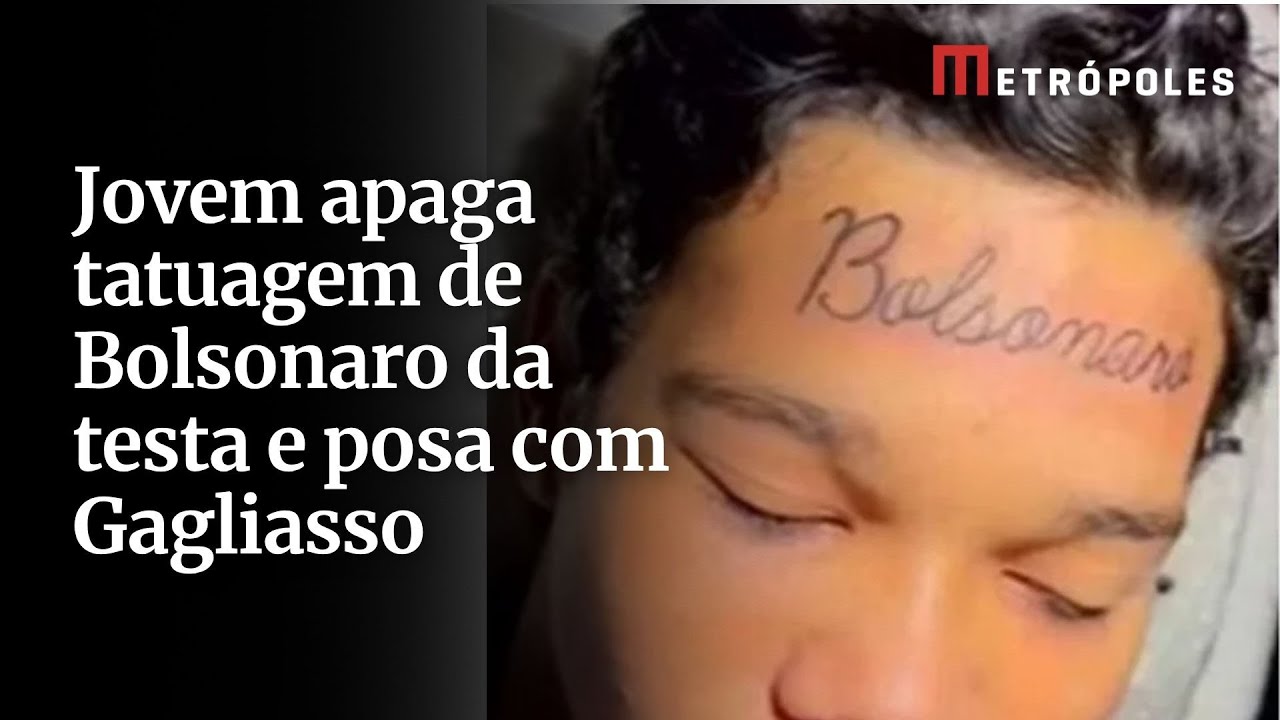 Jovem remove tatuagem de Bolsonaro da testa e tira foto com Gagliasso