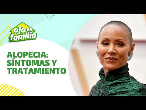 ALOPECIA: conozca más de la enfermedad que sufre la esposa de Will Smith