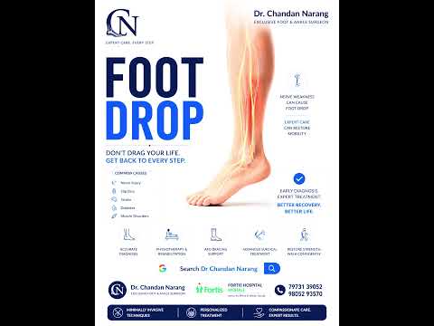 Ankle fusion explained using TTC NAIL | Best Foot and ankle surgeon | Dr Chandan Narang