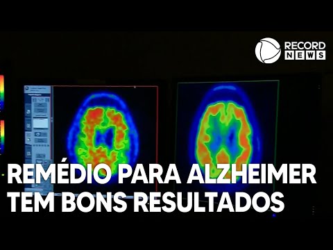 Medicamento apresenta bons resultados para impedir avanço de Alzheimer