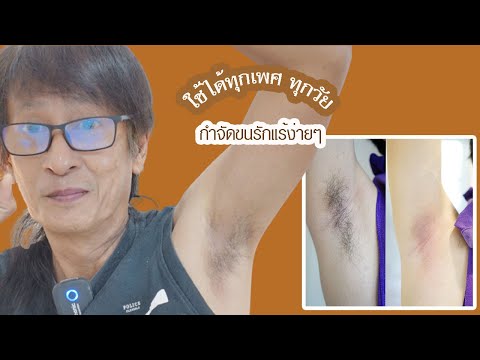 วิธีกำจัดขนรักแร้ผู้ชาย-จับผู้ วิธีกำจัดขนรักแร้ผู้ชาย-จับผู้