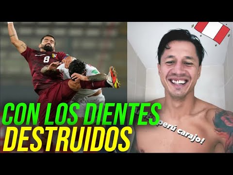 PERU VS VENEZUELA GIANLUCA LAPADULA REVELA CÓMO QUEDARON SUS DIENTES TRAS EL GOLPE DE TOMÁS RINCÓN