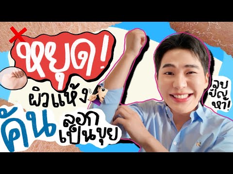 หยุดผิวแห้งคันลอกเป็นขุย!!!⎮