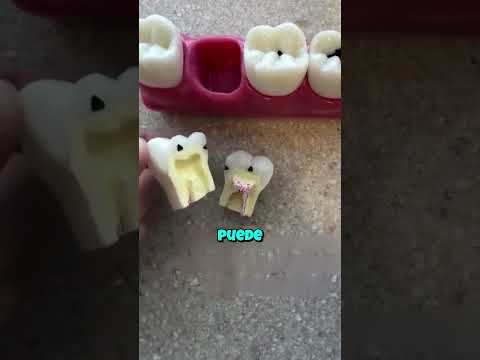 Una pequeña mancha es un problema 😬🥹