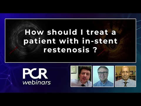 How should I treat a patient with in-stent restenosis ? – Webinar