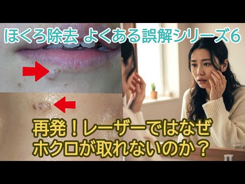 再発!レーザーでホクロが取れないのはナゼか?【ホクロ治療の誤解シリーズ 第6回】