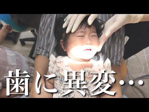 【1歳児】歯がおかしい…初めての歯科健診でパパママが知らない事実が発覚しました。