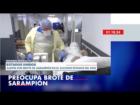 Autoridades sanitarias en alerta por brote de sarampión | Noticiero Estrella TV