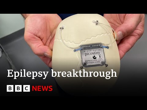 World's first epilepsy device fitted in boy's skull | BBC News