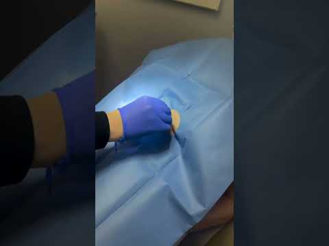 Dermatologist Performs a Punch Biopsy | Quick In-Office Skin Sampling