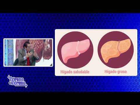 Dr. Gautreau con el tema: Hígado Graso/Enfermedad hepática más común | Extremo a Extremo