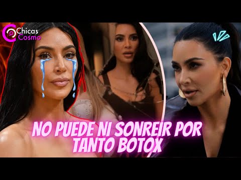 KIM KARDASHIAN SORPRENDE AL REVELAR QUE SE A PUESTO DEMASIADO BOTOX EN EL ROSTRO