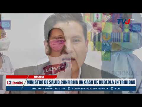 MINISTRO DE SALUD CONFIRMA UN CASO DE RUBÉOLA EN TRINIDAD