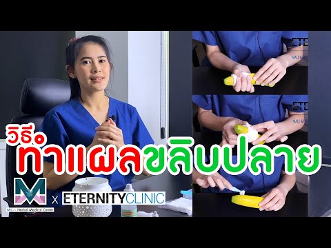 วิธีการดูแลแผลหลั่งขลิบหนังหุ้ วิธีการดูแลแผลหลั่งขลิบหนังหุ้