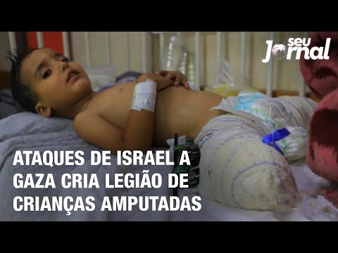 Ataques de Israel a Gaza cria legião de crianças amputadas