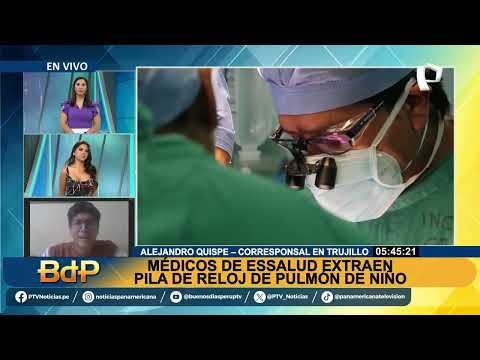 Trujillo: Médicos salvan la vida a niño que tenía una pila alojada en pulmón