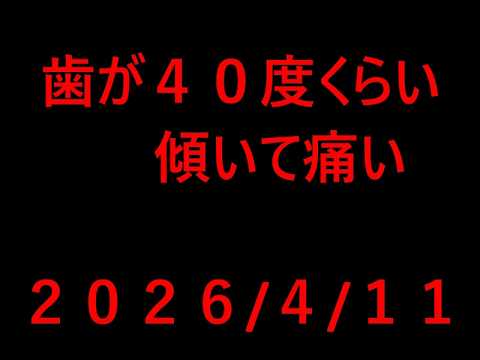 歯茎が痛くて作業サボってる話2026/4/11
