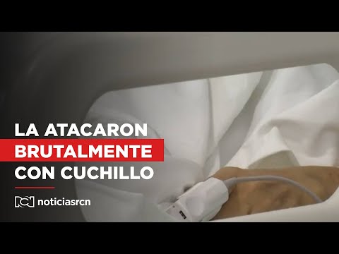 Mujer habría sido atacada con cuchillo a manos de su pareja sentimental