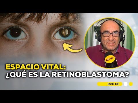 ¿Qué es la retinoblastoma o condición de los niños con ojos de gato? | Espacio Vital