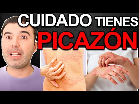 Porqué Me Pica La Piel? - Causas Y Soluciones Para Eliminar La Picazón