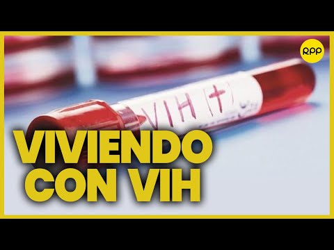 VIH: En el Perú el tamizaje  y tratamiento para VIH es gratis