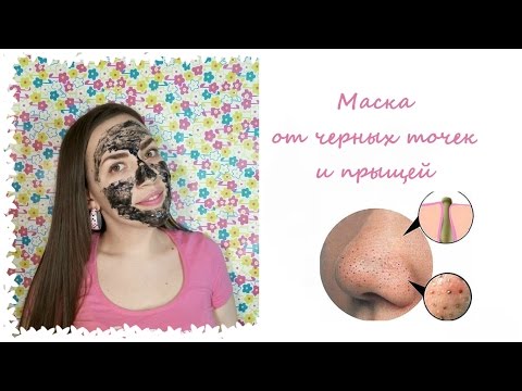 Маска от прыщей в домашних условиях ютуб Маска от прыщей в домашних условиях ютуб