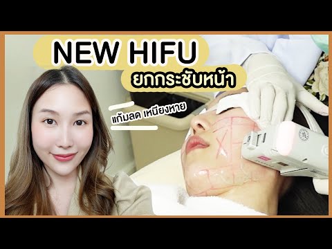 ปรับรูปหน้าด้วย-HIFU-ยกกระชับ- ปรับรูปหน้าด้วย-HIFU-ยกกระชับ-