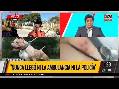 Córdoba: un chico sufrió el ataque de un pitbull