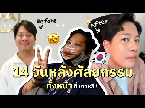 [173]อาการหลังผ่าตัดทำศัลยกรร