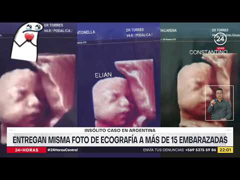 Insólito caso en Argentina: entregan misma foto de ecografía a más de 15 embarazadas