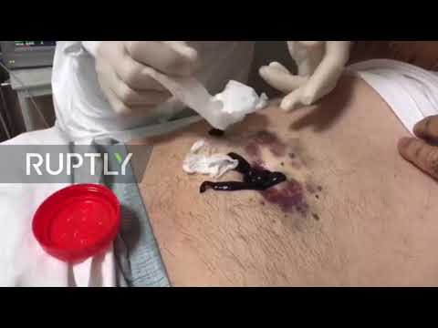 Russia: Doctors continue treating COVID-19 patients at Makhachkala city hospital