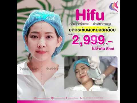 HIFU-ยกกระชับหย่อนคล้อย-ที่ยูน HIFU-ยกกระชับหย่อนคล้อย-ที่ยูน