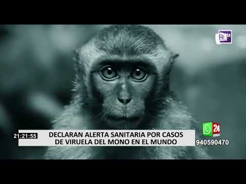 Viruela del mono: Perú declarará alerta sanitaria por aumento de casos en el mundo (2/2)