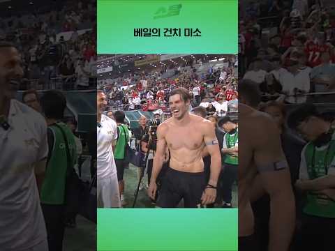 베일의 건치 미소