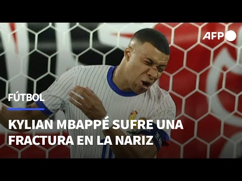 Kylian Mbappé sufre una fractura en la nariz | AFP