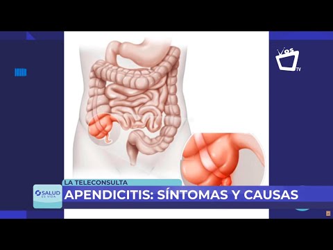 ¿Cómo saber si tenés apendicitis? Estas son los síntomos y las causas de este padecimiento