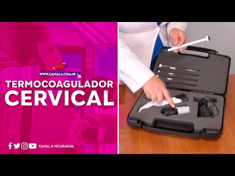 Gobierno Sandinista equipa al Hospital San Juan de Dios de Estelí con termocoagulador cervical