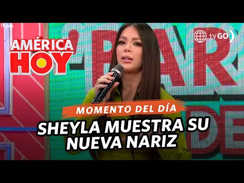 América Hoy: Sheyla Rojas habla de su operación de la nariz (HOY)