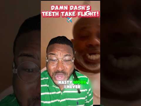 DAME DASH’S TEETH FLY OUT HIS MOUTH!  #DameDash #50Cent #greenscreen #shorts