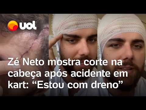 Zé Neto mostra ferimento na cabeça após acidente em kart: ‘Corte foi bem grande’; vídeo