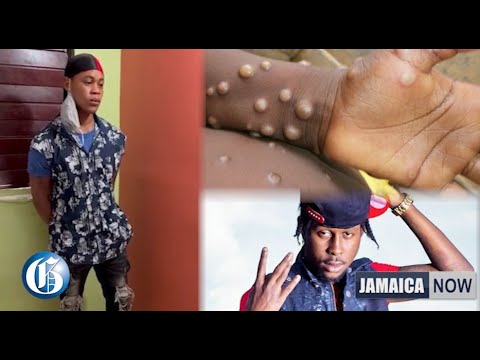 JAMAICA NOW: Popcaan problems | Monkeypox in Jamaica | Clarendon man slashes wife’s throat