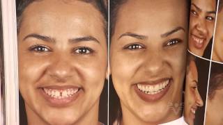 Dra. Rose Marques fala sobre lentes de contato dental no Viver Bem - TV Tribuna