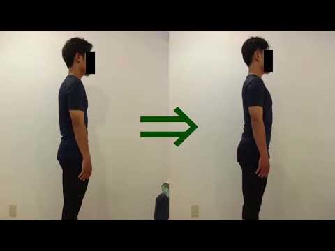 子供姿勢矯正の効果実績41 posture correction for child before and after