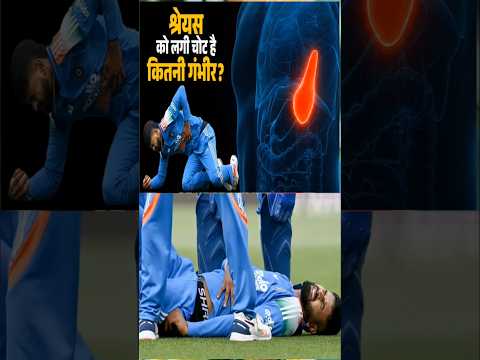 🩺 श्रेयस अय्यर को 😱 Sydney में लगी चोट से Team India परेशान! 🇮🇳 #INDvsAUS