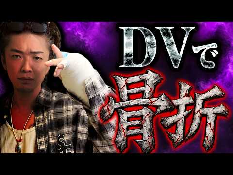 【骨折】ヒドいDVのせいで、過去最悪なバースデーを迎えました....。