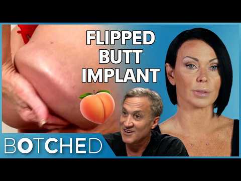 Flipped Butt Implants?! Renee's Body Dysmorphia Took A Painful Turn | Rejected By Botched | E!
