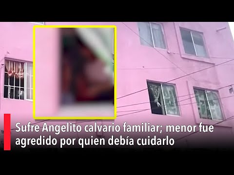 Sufre Angelito calvario familiar; menor fue agredido por quien debi?a cuidarlo